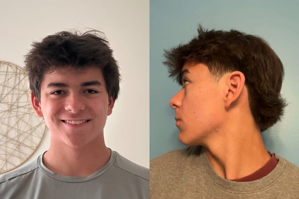Nicholas Yuan - After